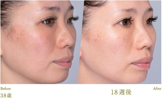 Lucia｜Kem dưỡng da Esthetic Skin Cream