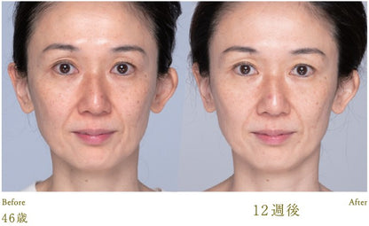 Lucia｜Mặt nạ dưỡng da Esthetic Skin Facial Mask (5 miếng)
