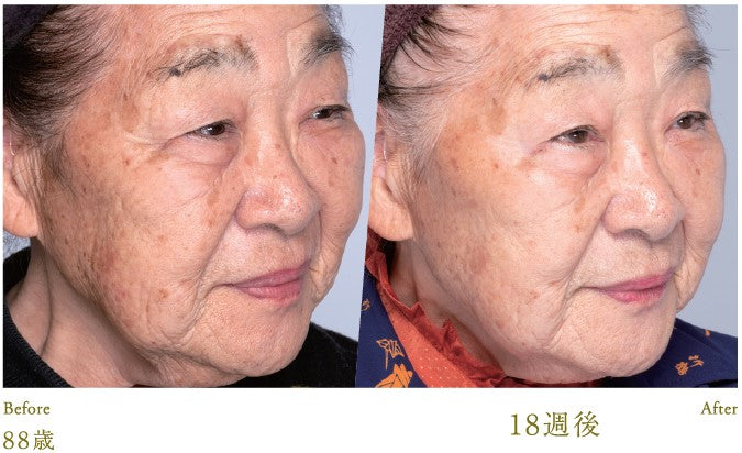 Lucia｜Kem dưỡng da Esthetic Skin Cream